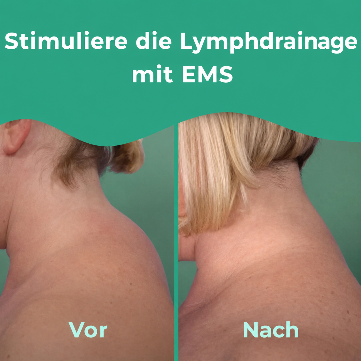 NACERVA™ | Intelligentes EMS-Nackenmassagegerät gegen Nackenbuckel & chronische Nackenschmerzen