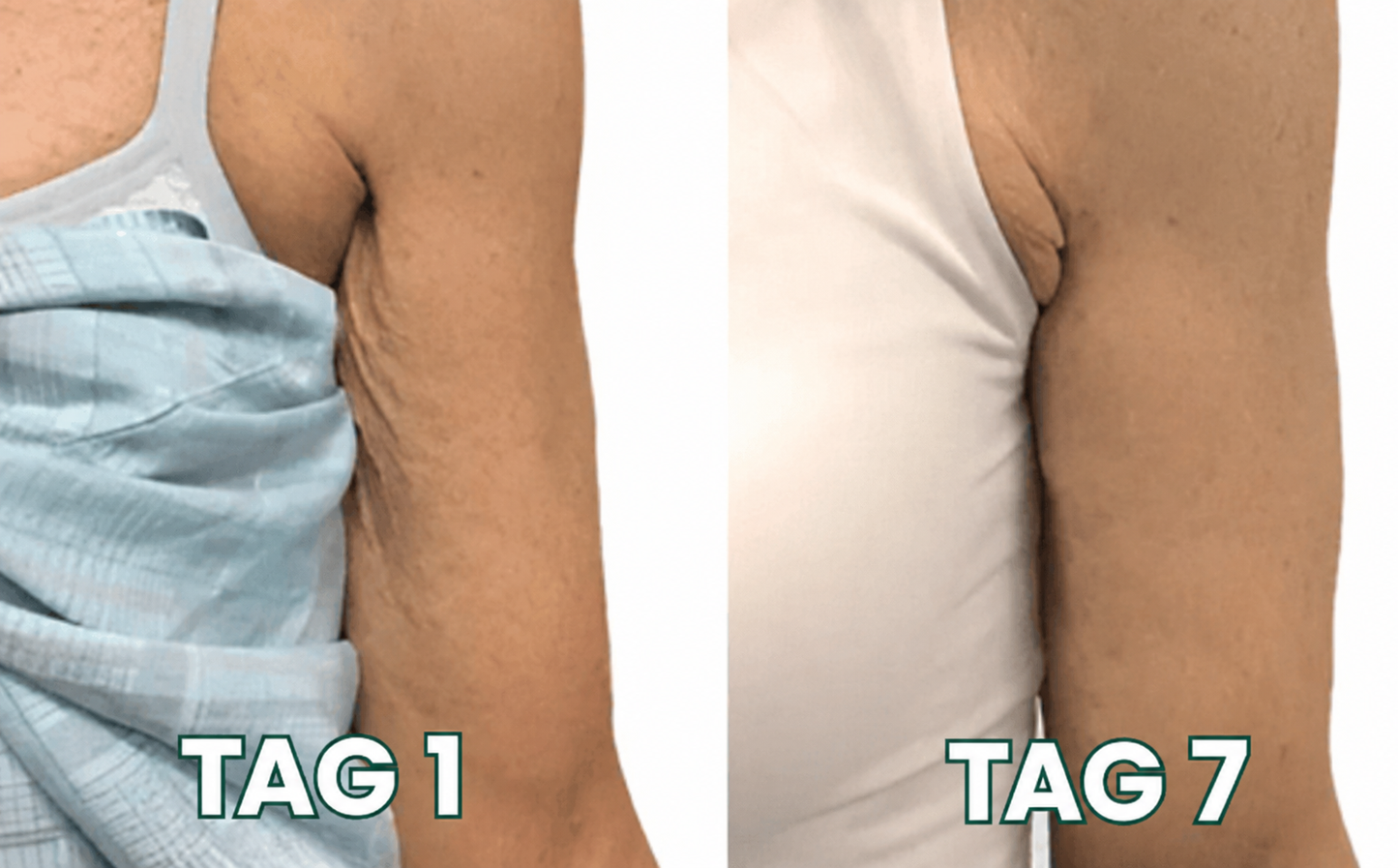 Collavé™ | Strafft, liftet und regeneriert erschlaffte Haut um bis zu 98 % innerhalb von 24 Stunden!