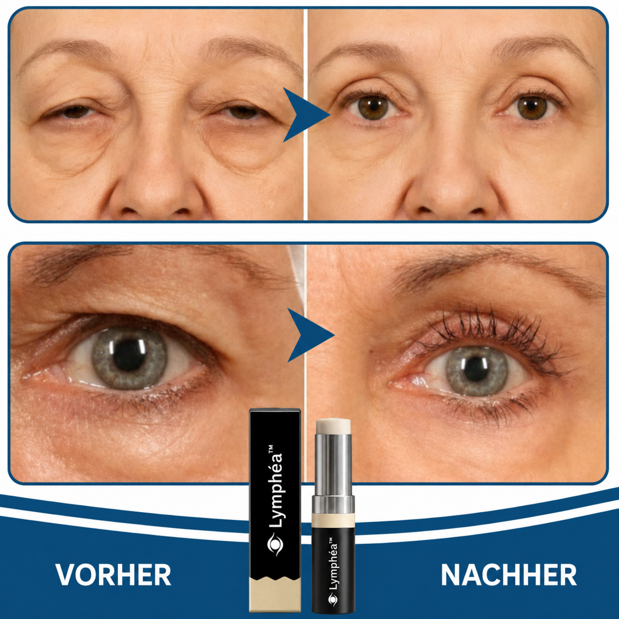 Lymphéa™ Augenbalsam | Tägliche Pflege für die Augenpartie