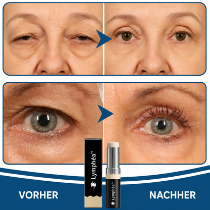 Lymphéa™ Augenbalsam | Tägliche Pflege für die Augenpartie