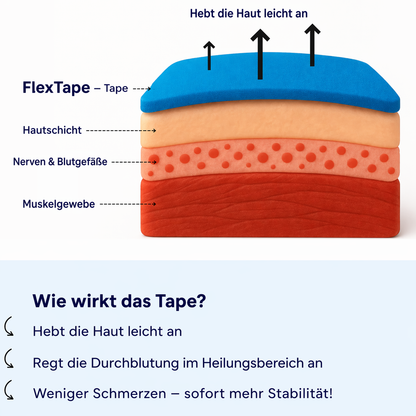 FLEXTAPE™ – Kinesiotape für dein Knie